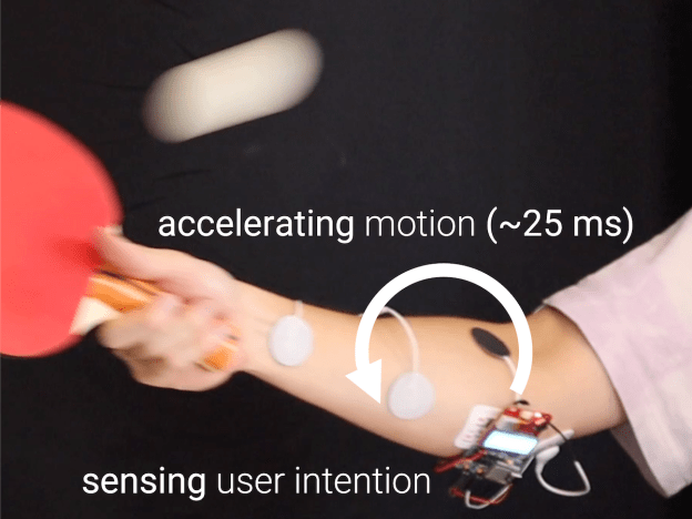 Myo Action electromyography and muscle stimulation study